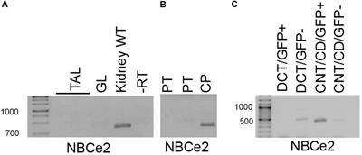 NBCe2 (Slc4a5) Is Expressed in the Renal Connecting Tubules and Cortical Collecting Ducts and Mediates Base Extrusion